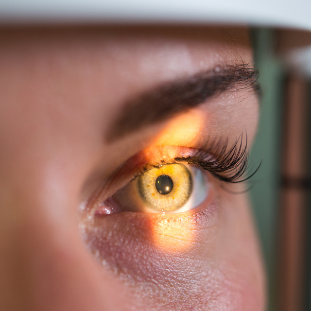 Vision Therapy in Dunedin